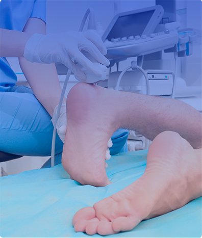 ULTRASONIDO DOPPLER ARTERIAL Y VENOSO DE MIEMBRO INFERIOR IZQUIERDO