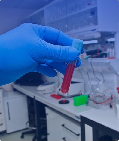 QUIMICA SANGUINEA DE 6 ELEMENTOS