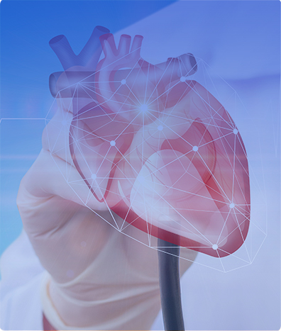 ELECTROCARDIOGRAMA EN ESFUERZO