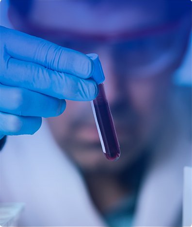 NEUROFISIOLOGÍA ELECTROMIOGRAFIA SACROS Y VELOCIDAD DE CONDUCCION NERVIOSA