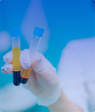 PROTEINA EPIDIDIMAL HUMANA 4
