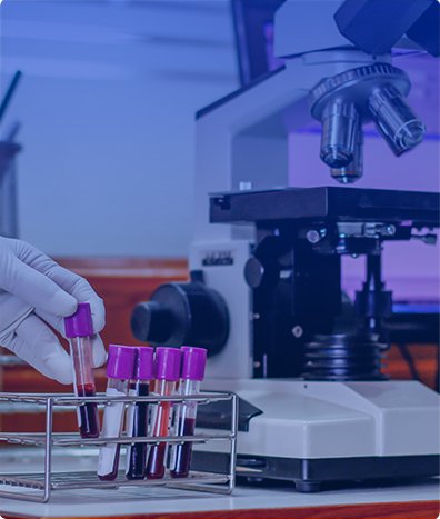 MICRODELECIONES DEL CROMOSOMA Y