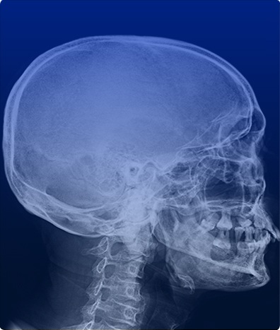 RAYOS X COL CERVICAL AP. LAT Y OBLICUAS - 4