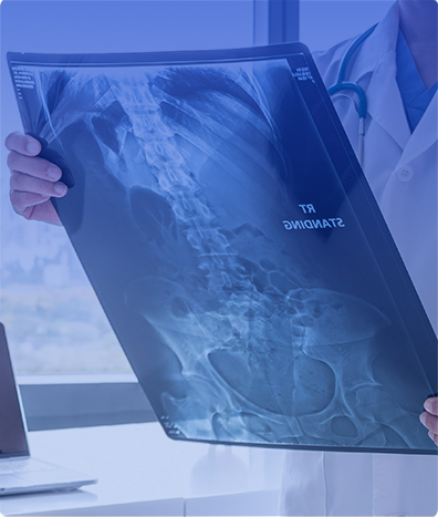 RADIOLOGÍA CONTRASTADA SERIE ESOFAGO GASTRO-DUODENAL.
