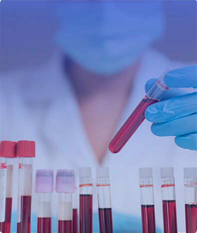 DESOXIPIRIDINOLINA (DPD)