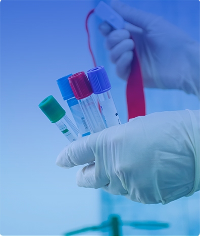 Apolipoproteína A1