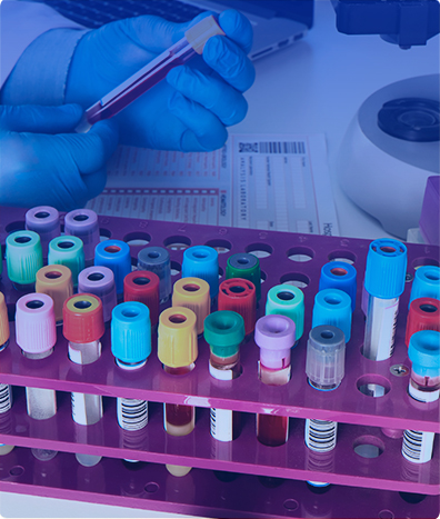 Proteína amiloide A (SAA)