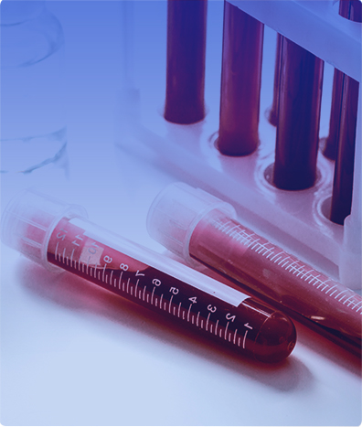 VIH1 VIH2 ANTICUERPOS INMUNOCROMAT. SUPLEMENTARIA