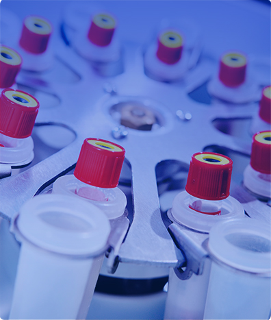 ENTEROVIRUS POR PCR