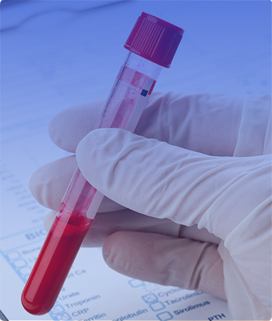 ACIDOS BILIARES HPLC