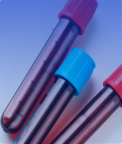 CARBOXIHEMOGLOBINA