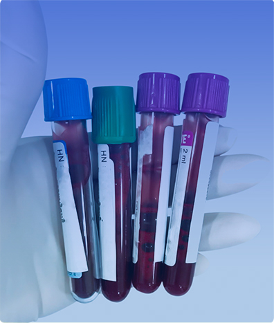 FACTOR ANTIGENICO VON WILLEBRAND