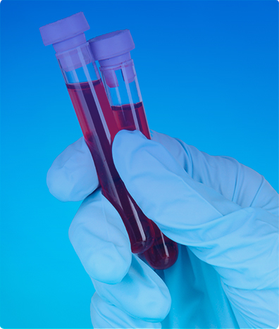 HEPATITIS A ANTICUERPO IGG