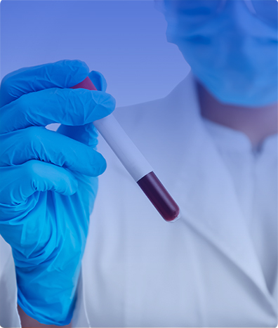 CULTIVO DE MYCOPLASMA Y UREAPLASMA GENITAL