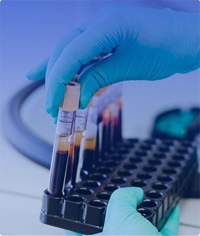 Anticuerpos IgE específicos a proteínas séricas de rata