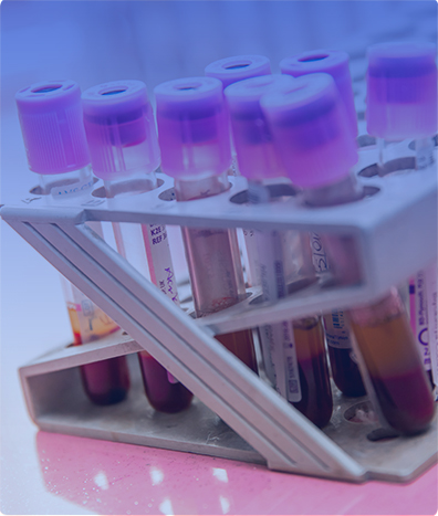 AC ANTI-RECEPTOR DE TSH