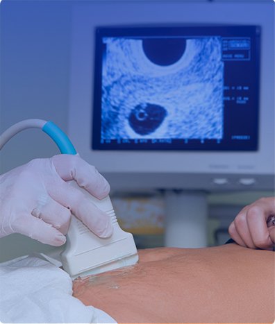 ULTRASONIDO DOPPLER ARTERIAL Y VENOSO DE MIEMBRO SUPERIOR DERECHO