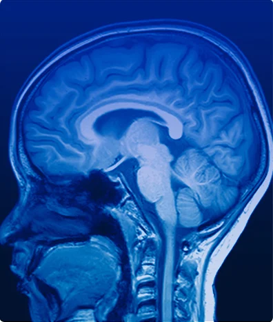 NEUROFISIOLOGÍA POTENCIALES EVOCADOS AUDITIVOS PEDIATRICO