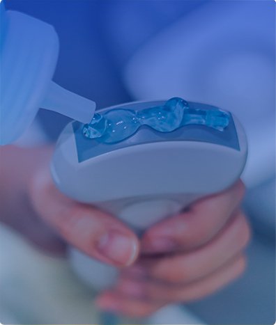 ULTRASONIDO PELVICO TRANS-VAGINAL
