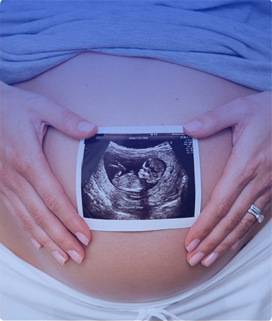 ULTRASONIDO OBSTETRICO GEMELAR