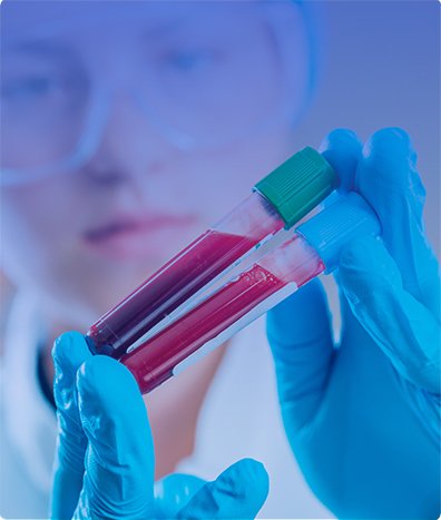 PANEL DE INMUNOHISTOQUÍMICA PARA DIAGNÓSTICO 4-5 ANTICUERPOS