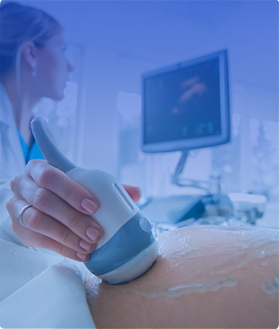 ULTRASONIDO OBSTETRICO CON DOPPLER
